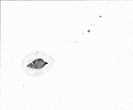 20110119_zonnevlekken